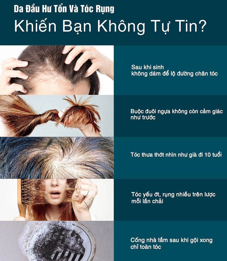 Dầu Gội Thảo Dược ESSEHAIR