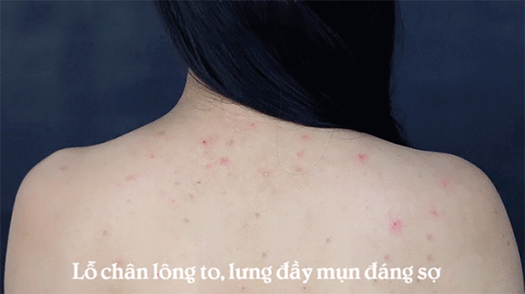 Kem Trang điểm chống nắng MKUP