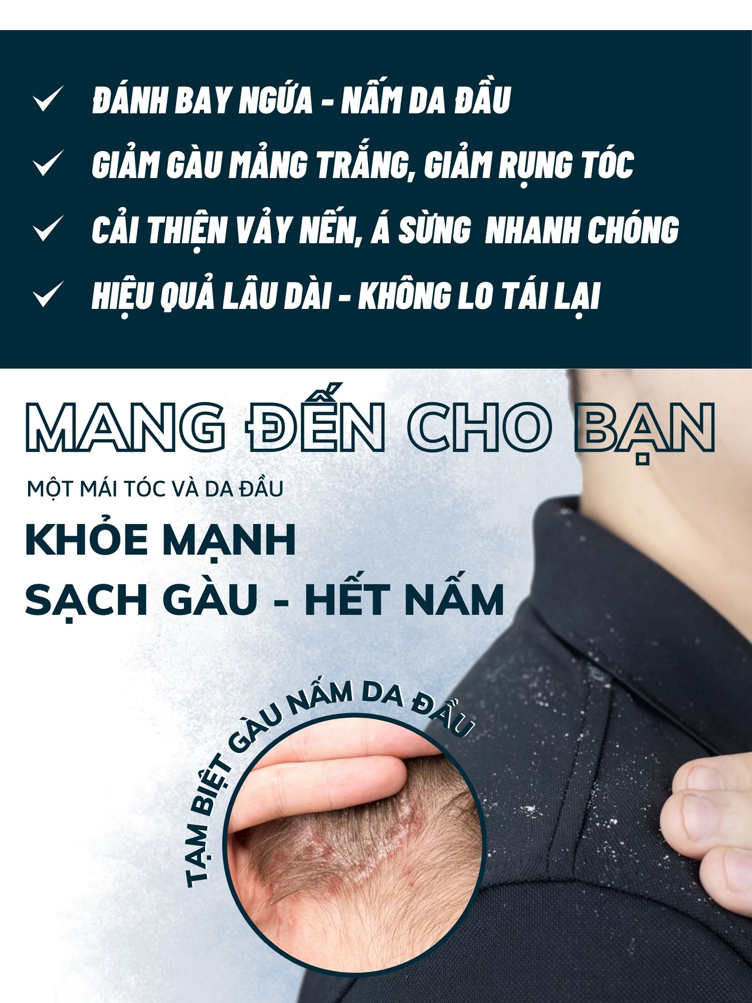 Dego Pharma - Dầu gội sạch vảy gàu mảng trắng, hết ngứa chiết xuất thiên nhiên từ vỏ cây Zizyphus, sản xuất theo tiêu chuẩn và dưới sự giám sát của công ty dược phẩm Châu Âu (80ml)