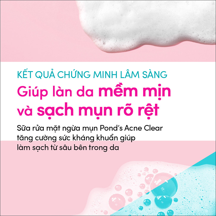 Sữa Rửa Mặt Ngừa Mụn Pond's Acne Clear (50g)