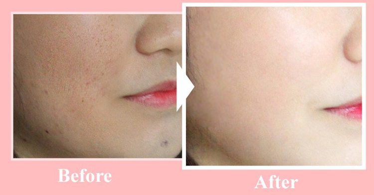 Phấn Nước Real Cover Pink Cushion SPF50+/Pa+++ 20g (Phân Phối Bởi Nhà Bán Hàng)