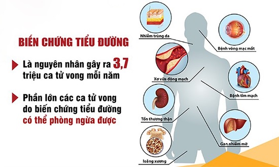 Combo 2 hộp Viên tiểu đường Akidiabet - Giảm đường huyết, ngăn ngừa biến chứng tiểu đường, giảm mỡ máu. Lọ 60 viên. SP đạt chuẩn GMP - WHO, được Sở Y Tế cấp phép. 2