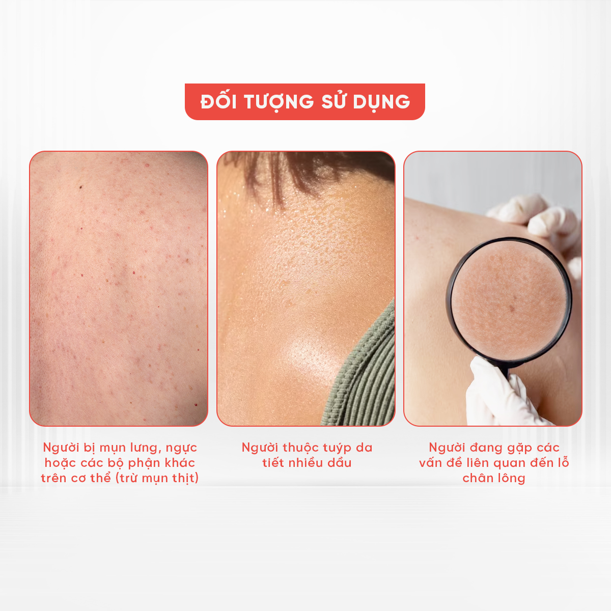 Sữa Tắm Giảm Mụn Lưng Oriss Làm Mờ Vết Thâm, Sẹo Mụn Chai 300ml ...