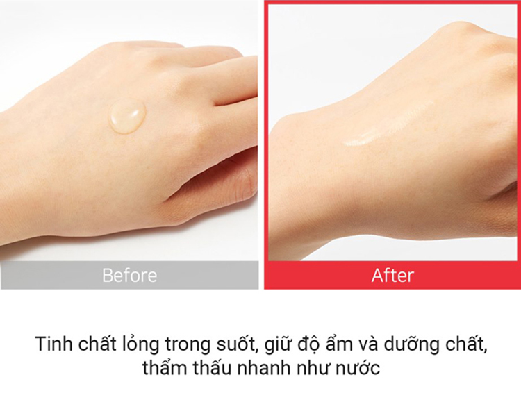 Tinh Chất Phục Hồi Da Tổn Thương Some By Mi Snail Truecica Miracle Serum 50ml