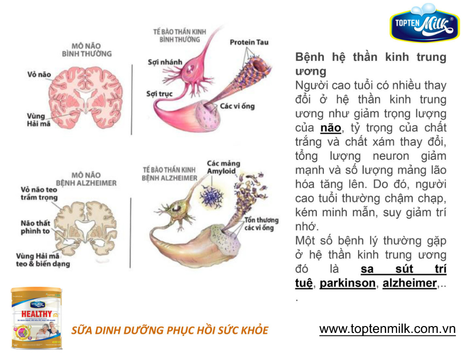 Sữa bột tăng cân,hổ trợ tiêu hóa healthy 800g topten milk