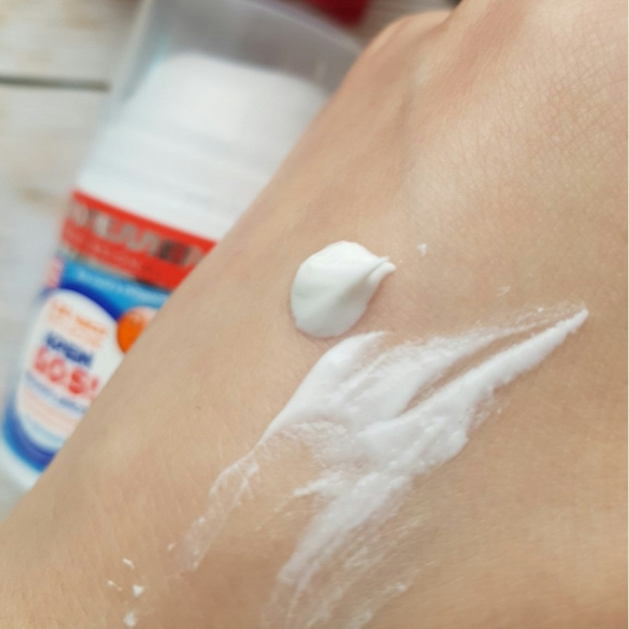 review su dung kem tri mun sos