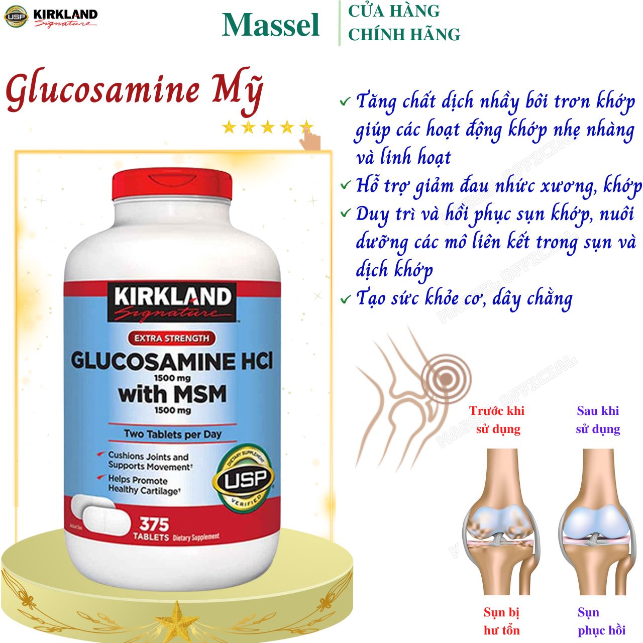 Glucosamine Mỹ Kirkland Signature Glucosamine HCL 1500mg With MSM 1500mg