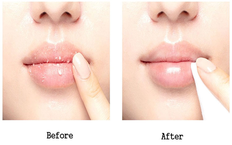 Innisfree Lip peeling Booster 15ml)