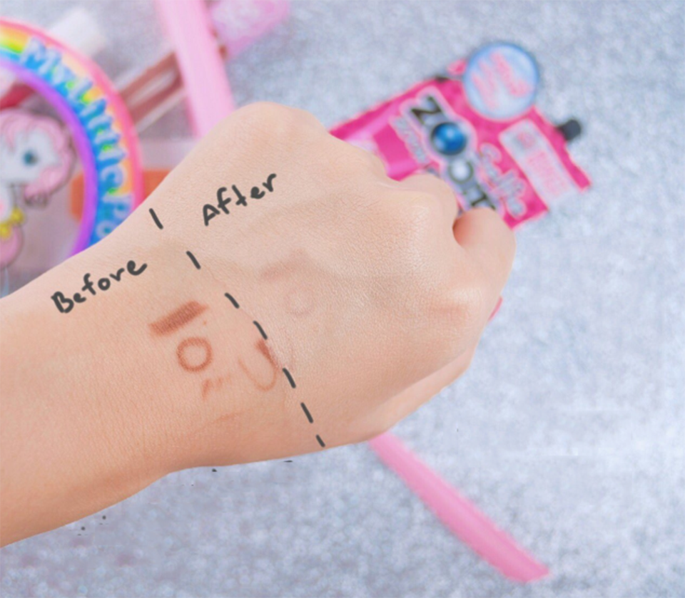 kem-nen-khong-gay-bit-tac-lo-chan-long