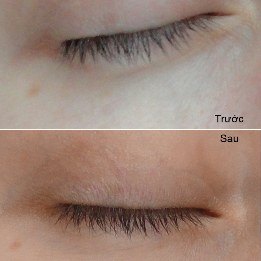 review hieu qua su dung kem mat klirvin