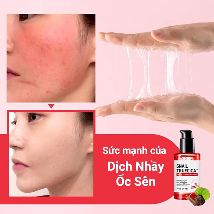 Tinh Chất Phục Hồi Da Tổn Thương Some By Mi Snail Truecica Miracle Serum 50ml