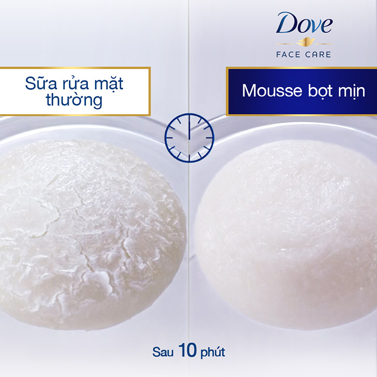 Sữa Rửa Mặt Dạng Bọt Dove Tinh Chất - Serum Cấp Ẩm & Cho Da Mềm Mượt 160Ml