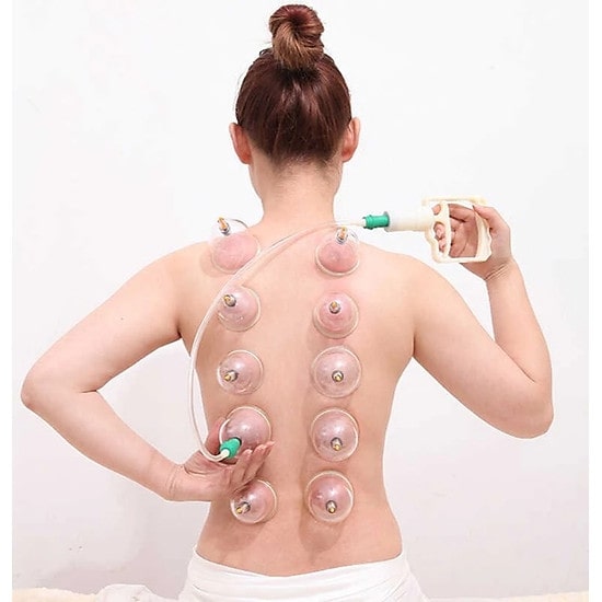 Bộ Dụng Cụ Giác Hơi Không Dùng Lửa 24 Ly Cao Cấp - Hàng Chính Hãng
