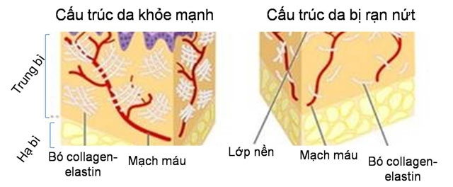 Kem Giúp Ngăn Hình Thành Các Vết Rạn Da Oillan Mama Multi-Active Stretch Mark Preventing Body Balm 200ml - 4610 