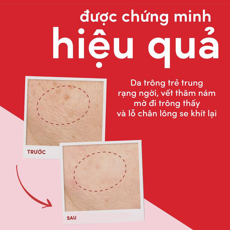 Kem Ngăn Ngừa Lão Hóa Pond's Age Miracle Ban Ngày SPF 18 PA++ (50g)