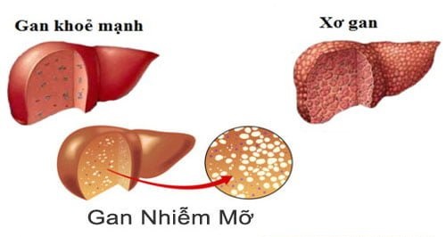 Viên uống bổ gan Hepalyse EX 240 viên Nhật Bản