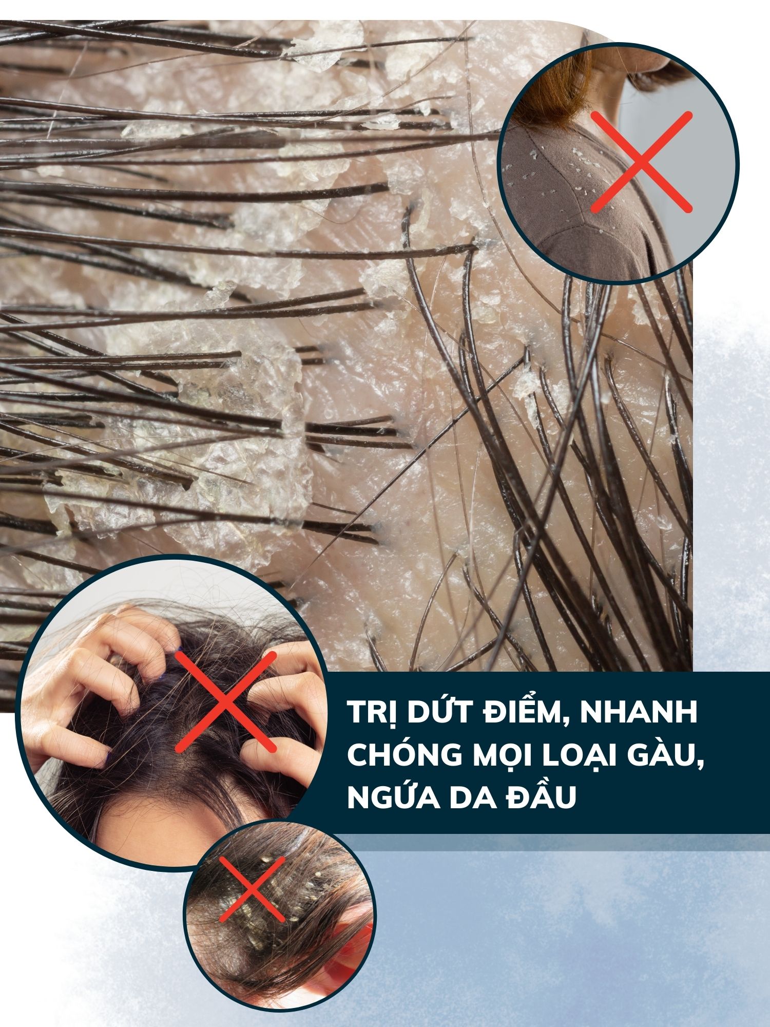 Combo 2 dầu gội sạch gàu hết ngứa Dego Pharma chiết xuất hoàn toàn từ thiên nhiên cải thiện tình trạng vảy nấm (80ml)