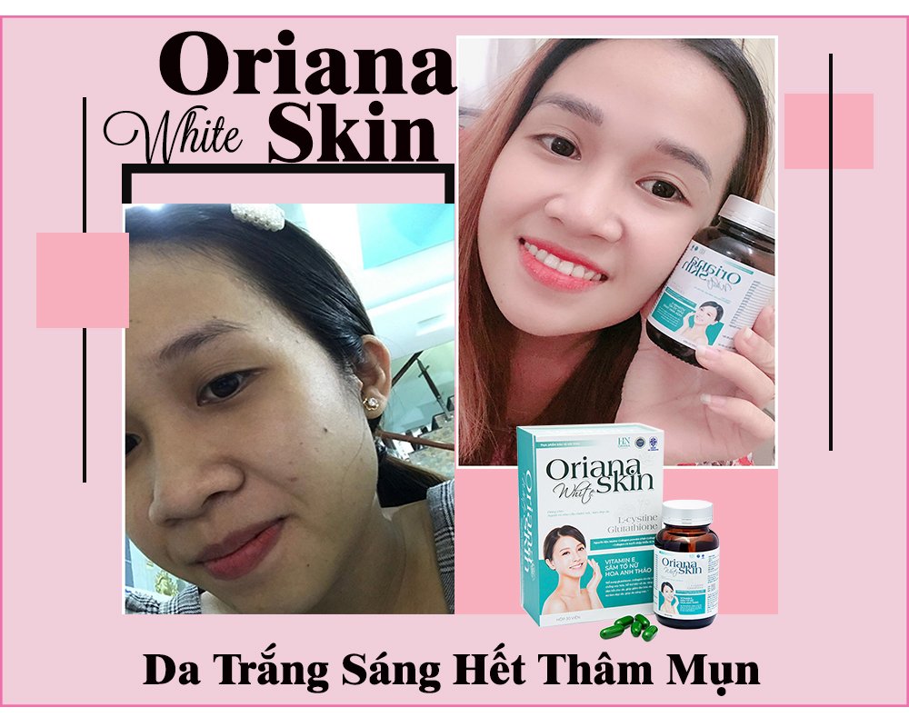 Viên uống trắng da HN Oriana Cosmetic 1