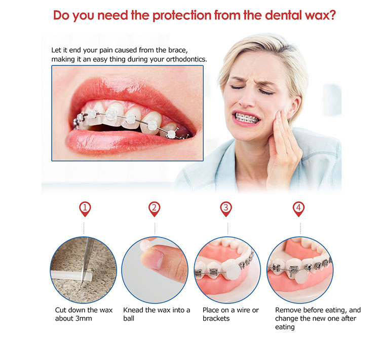 5 Boxes/pack Brace Gum Irritation Relief Wax For Braces Wearer Protector Dental Orthodontics Teeth