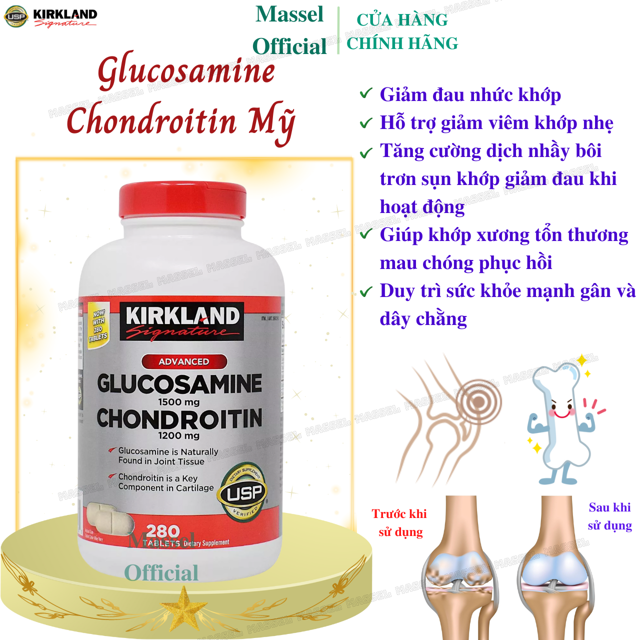 Glucosamine Mỹ Kirkland Signature Glucosamine HCL 1500mg With MSM 1500mg
