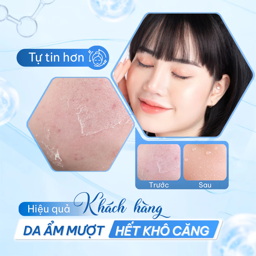 Xịt Khoáng Compliment Revitalizing Cấp Ẩm Tức Thì, Phục Hồi Và Làm Dịu Da Nhạy Cảm 200ml