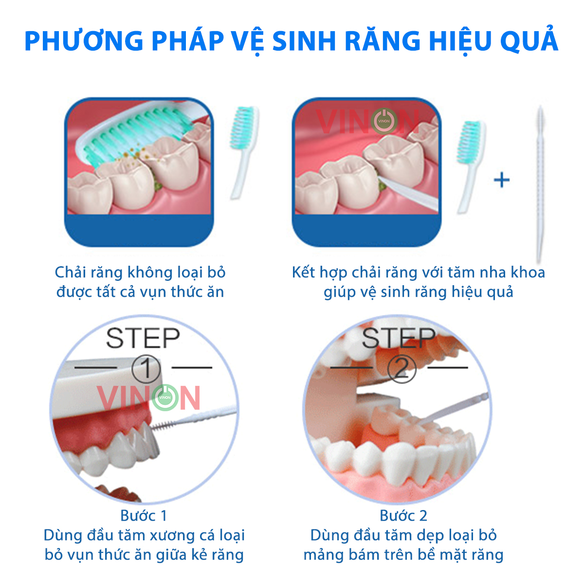 Tăm nhựa nha khoa CHÍNH HÃNG VINON (hộp 300 cây)