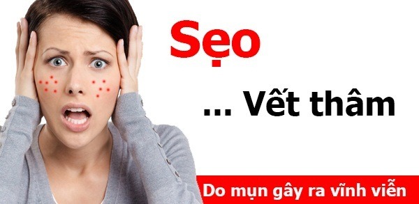 tác hại của mụn gây ra