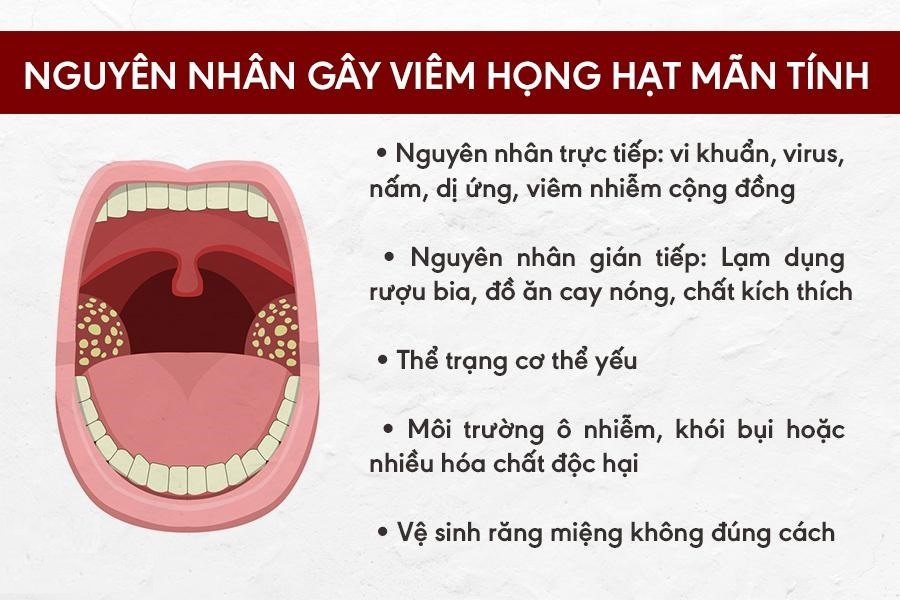 Thực phẩm chức năng Xịt họng Keo ong đen Vitatree hỗ trợ điều trị và phòng ngừa viêm, đau, rát họng - Vitatree Super Propolis Spray Complex (30 ml) 2