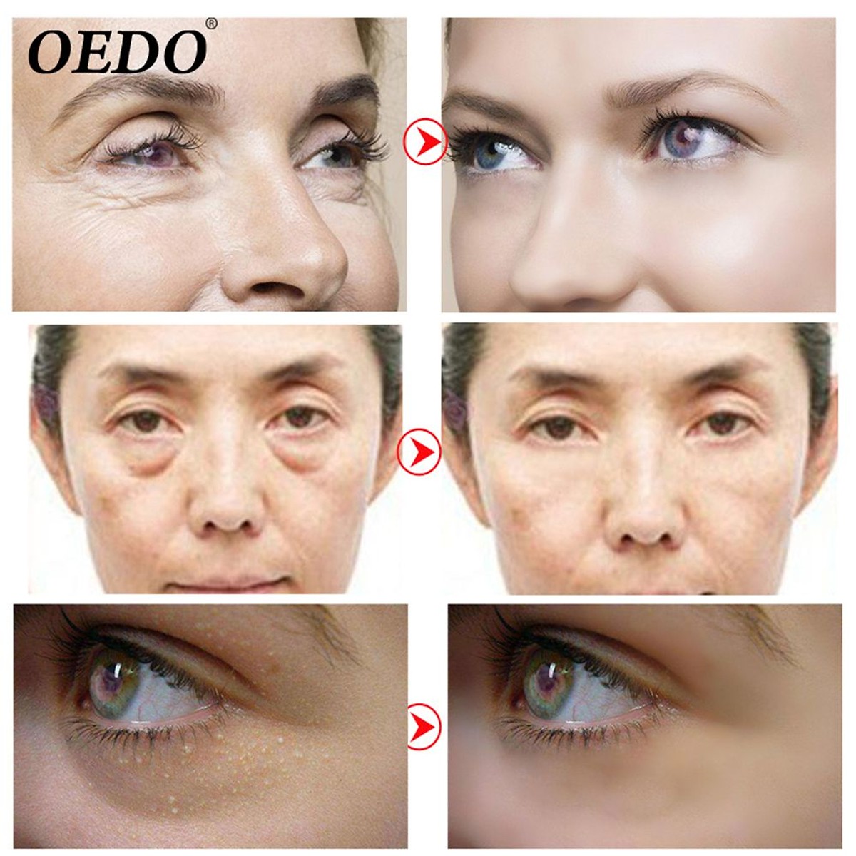 Mặt Nạ Collagen Chống Quầng Thâm Mắt OEDO (2 Miếng)