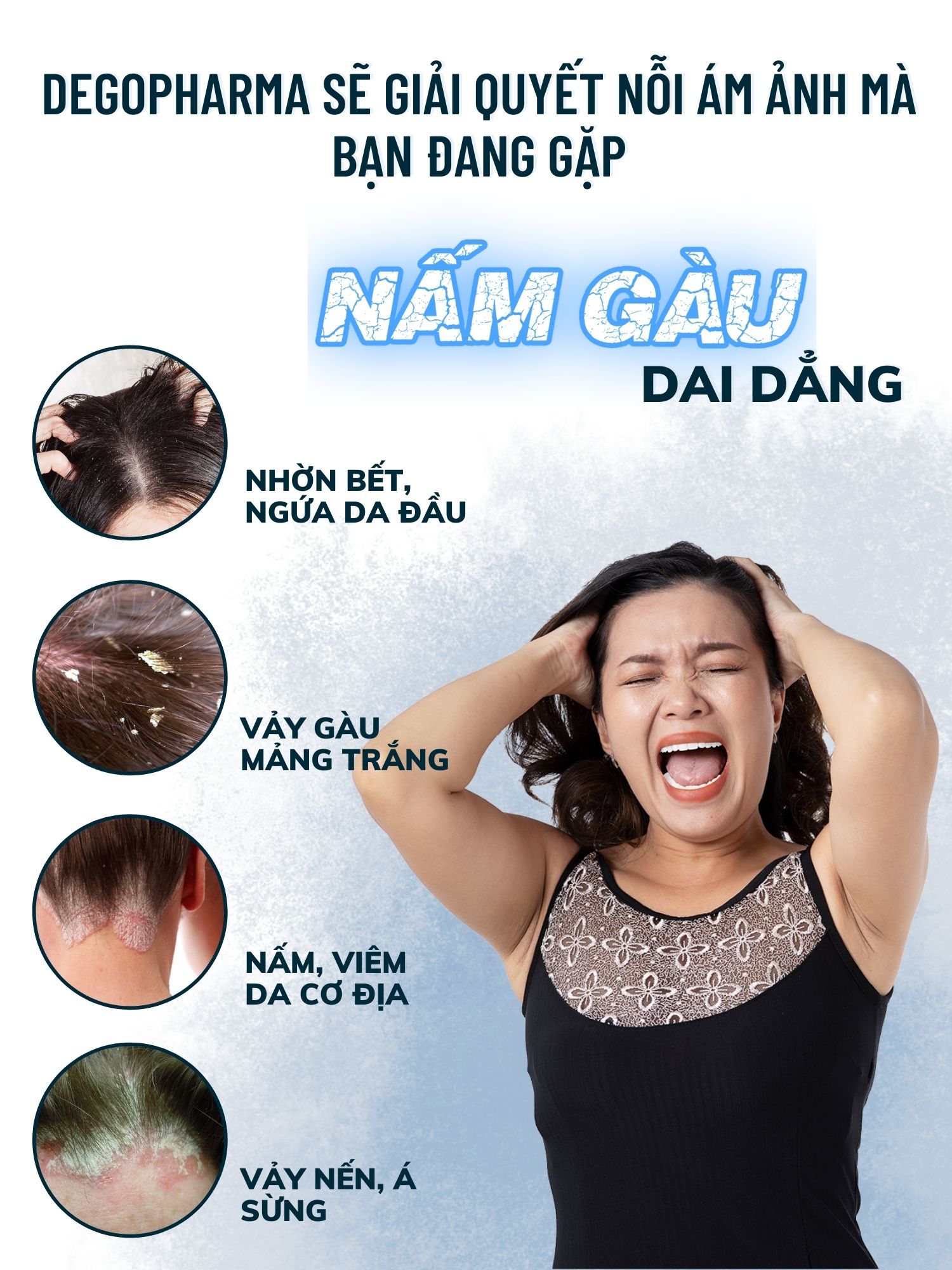 Dego Pharma - Dầu gội sạch vảy gàu mảng trắng, hết ngứa chiết xuất thiên nhiên từ vỏ cây Zizyphus, sản xuất theo tiêu chuẩn và dưới sự giám sát của công ty dược phẩm Châu Âu (80ml)