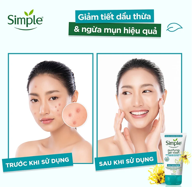 Combo 2 Sữa rửa mặt Simple giúp kiềm dầu và ngừa mụn hiệu quả - cho da mụn nhạy cảm 150ml [CHÍNH HÃNG ĐỘC QUYỀN] [DIỆN MẠO MỚI]