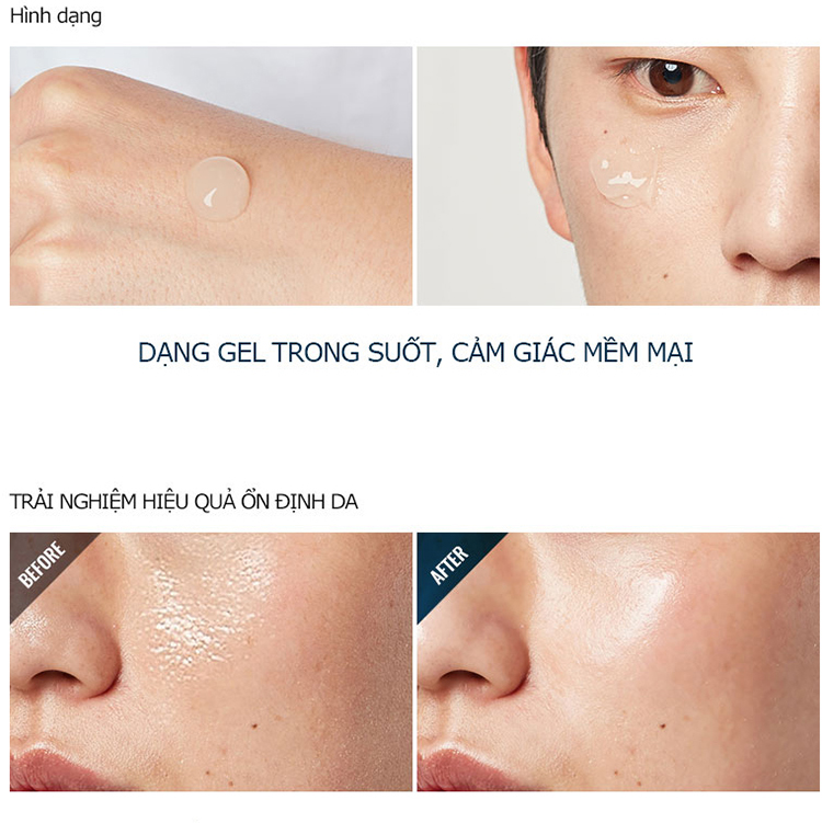 Kem Dưỡng Tổng Hợp 5 Trong 1 Cho Da Nhờn - M'Solic Oil Defender All-In-One (130ml)