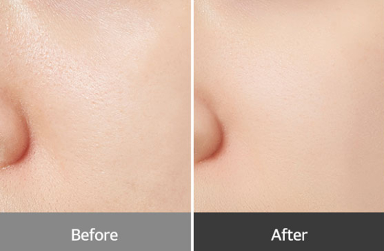 Kem Lót Trang Điểm A'Pieu Start Up Matt Primer (30ml)