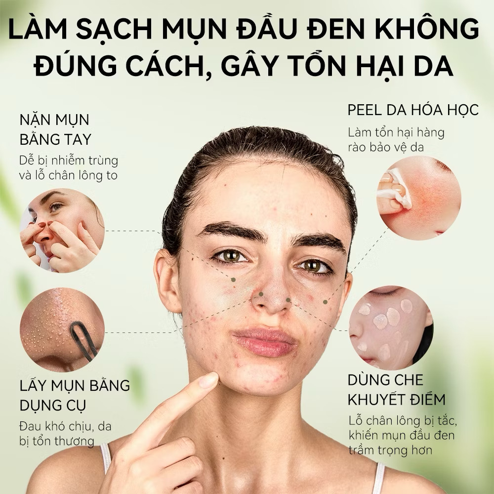 Gel Lột Mụn Than Tre Hoạt Tính OKESHOP 30ml - Giải Pháp Loại Bỏ Mụn Đầu Đen - Mụn Cám - Bạ Nhờn - Làm Sạch Sâu Và Thu Nhỏ Lỗ Chân Lông