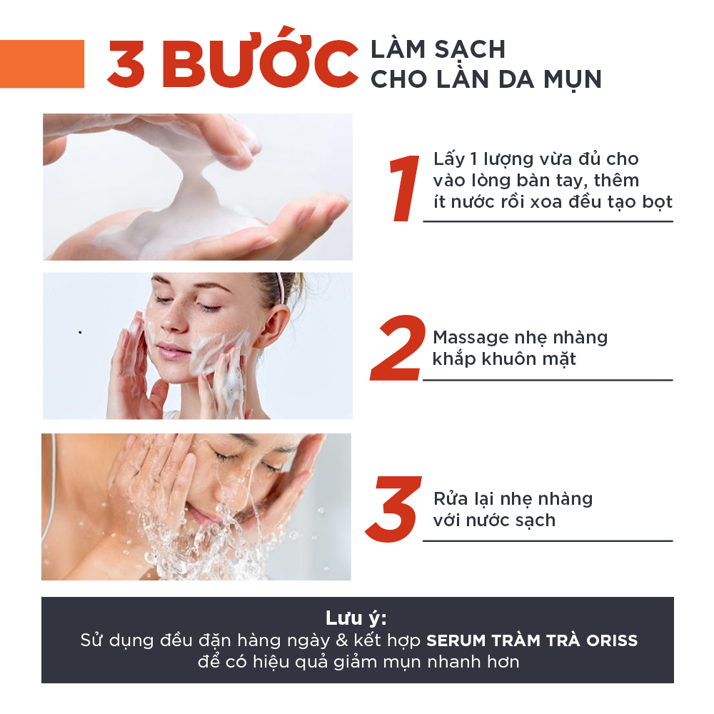 Sữa Rửa Mặt Tạo Bọt Ngừa Mụn Oriss 100g - Chuyên Dành Cho Da Mụn