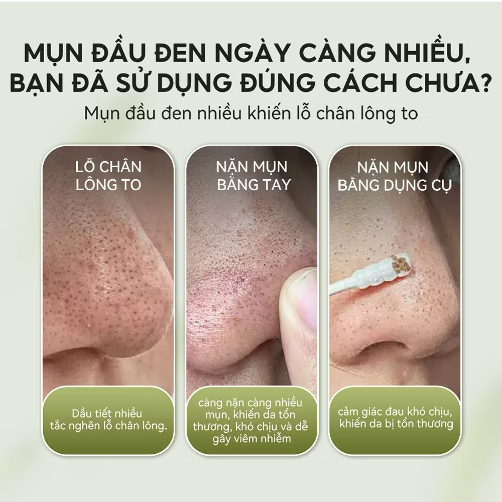 Gel Lột Mụn Nha Đam OKESHOP 30ml - Giải Pháp Loại Bỏ Mụn Đầu Đen - Mụn Cám - Bạ Nhờn - Làm Sạch Sâu Và Thu Nhỏ Lỗ Chân Lông