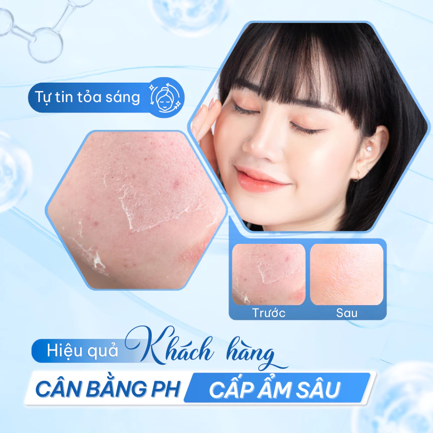 Toner Compliment No Problem Salicylic Acid Làm Sạch Da Kiềm Dầu Giảm Mụn 200ml