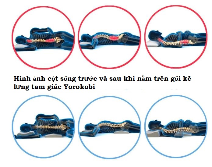 gối kê lưng thoát vị đĩa đệm yorokobi ( giao màu ngẫu nhiên ) 7