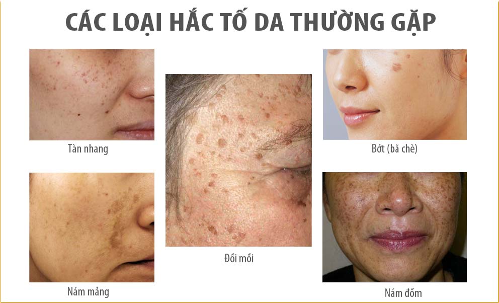 Thực phẩm chức năng Viên uống Nhau thai cừu và Sữa ong chúa Vitatree Marine Collagen Plus (100 Viên) - Nhập khẩu Australia 4