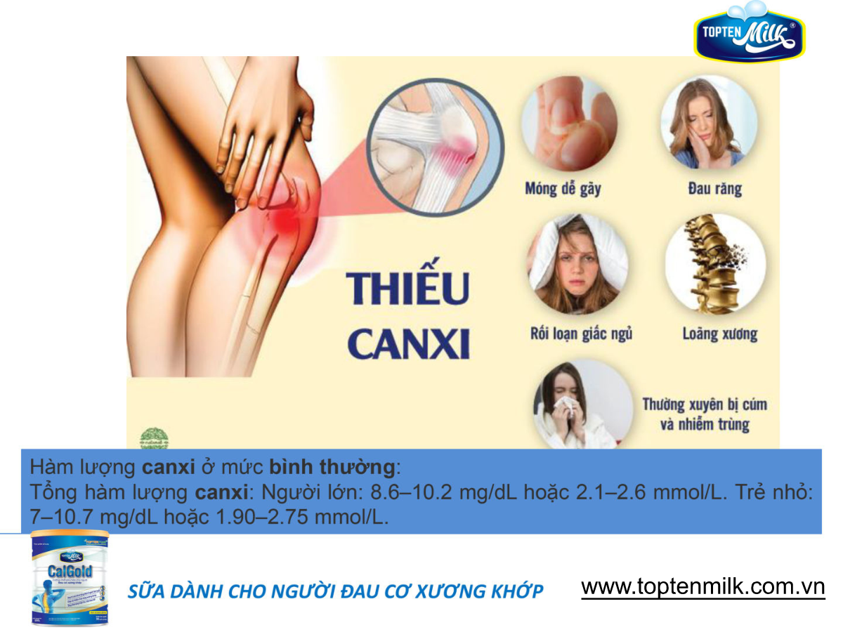 Sữa xương khớp ,bổ sung canxi cal gold 400g topten milk