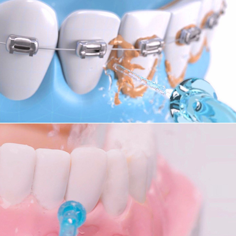 Xiaomi Soocas Oral Irrigator W3 Portable Water Dental Flosser Water Jet Cleaning Tooth Toothpick Mouthpiece Denture