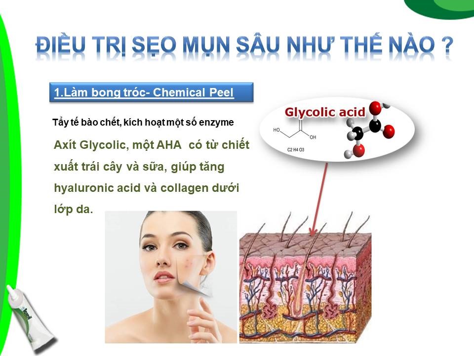 Acnesil Gel Silicone Cho Giải Pháp Hiệu Quả Cho Sẹo Mụn 10g Acnesil Gel Silicone Cho Giải Pháp Hiệu Quả Cho Sẹo Mụn 10g