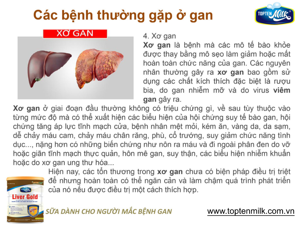 Sữa dinh dưỡng cho gan ,mát gan giải độc liver gold 800g topten milk