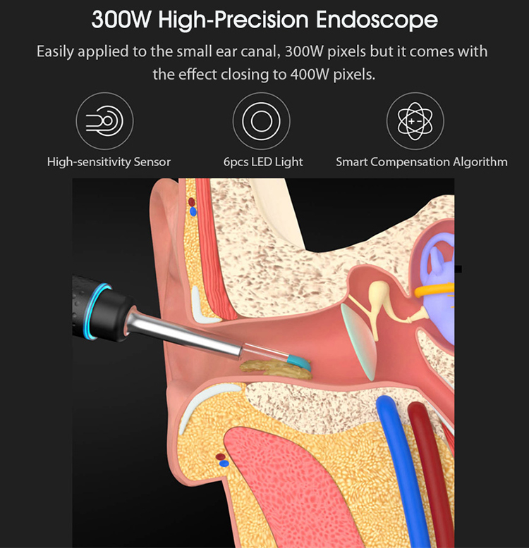 Xiaomi Youpin Bebird Smart Visual Ear Stick M9 Pro Multifunctional 17 Picking Heads 300W High Precision Endoscope 350mAh