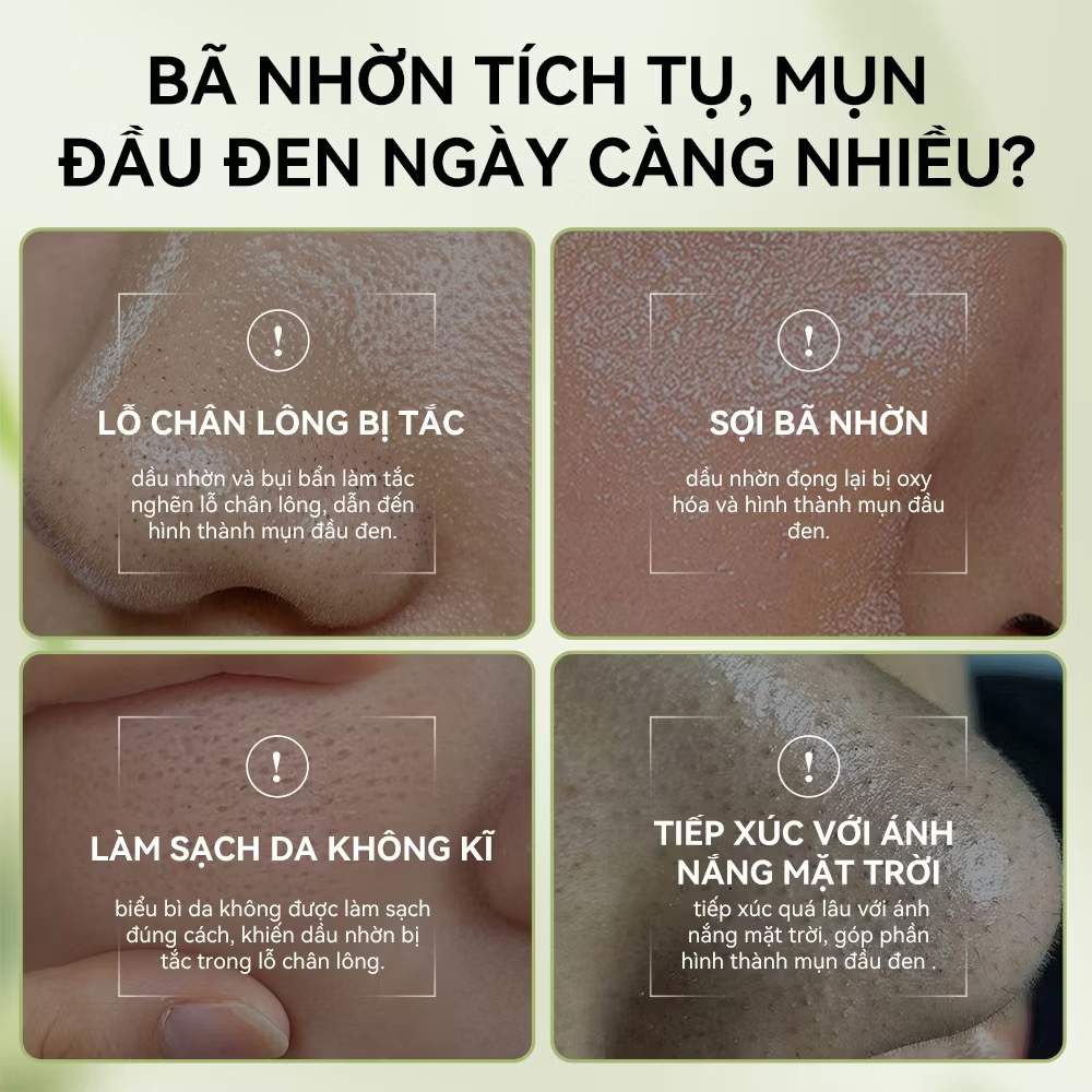 Gel Lột Mụn Than Tre Hoạt Tính OKESHOP 30ml - Giải Pháp Loại Bỏ Mụn Đầu Đen - Mụn Cám - Bạ Nhờn - Làm Sạch Sâu Và Thu Nhỏ Lỗ Chân Lông