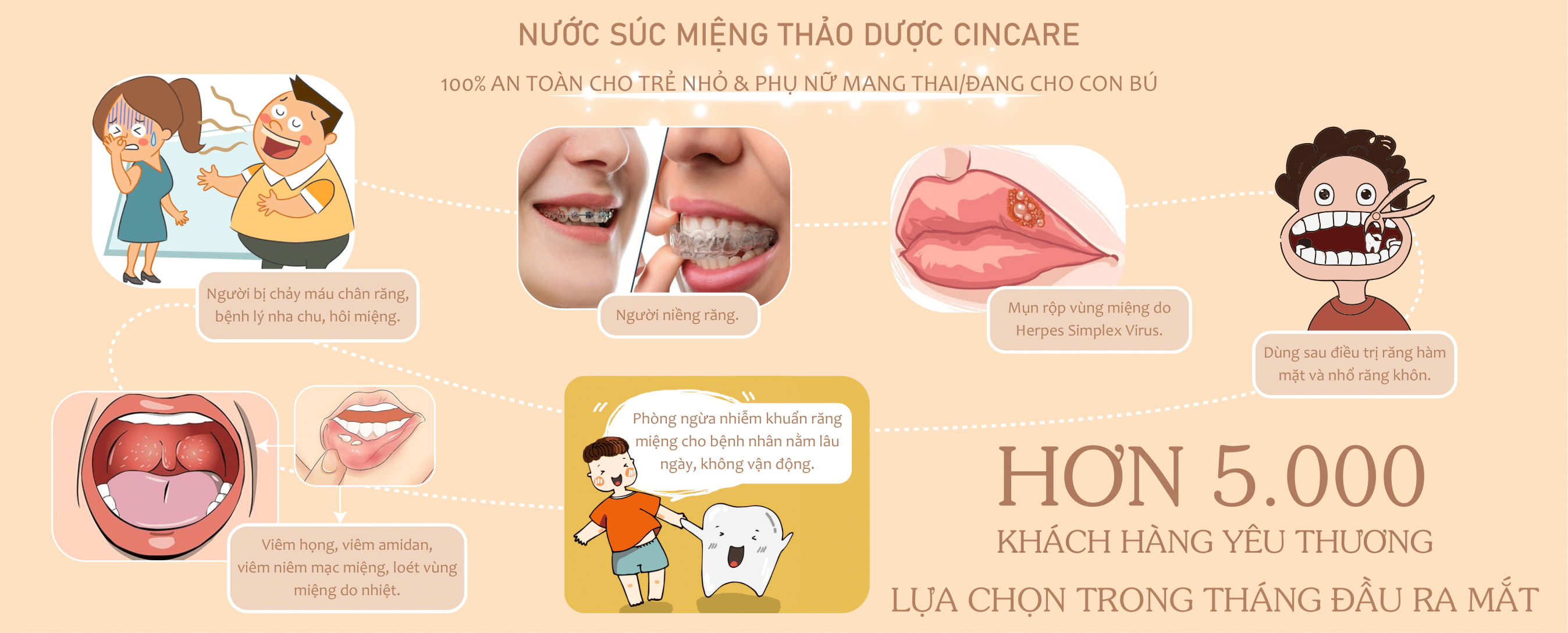 Combo 5 chai Nước súc miệng Thảo dược Cincare - Ngăn ngừa virus, bảo vệ nướu răng, ngừa nhiệt miệng, nha chu (300ML) 2