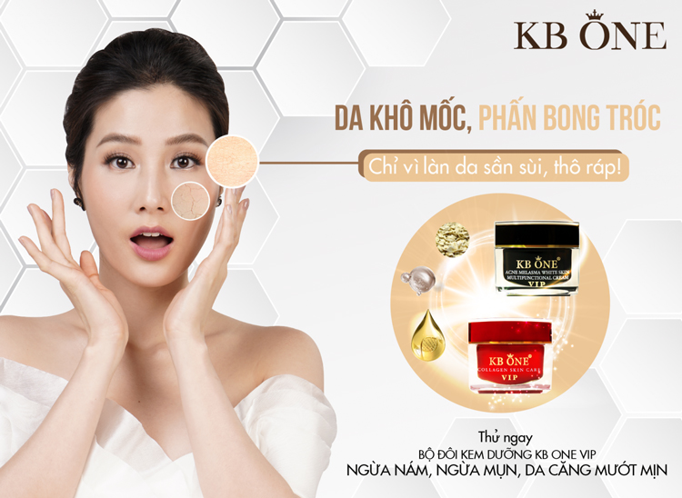 Kem Dưỡng Ngừa Mụn Trắng Da Kb One Vip Đen (50g)