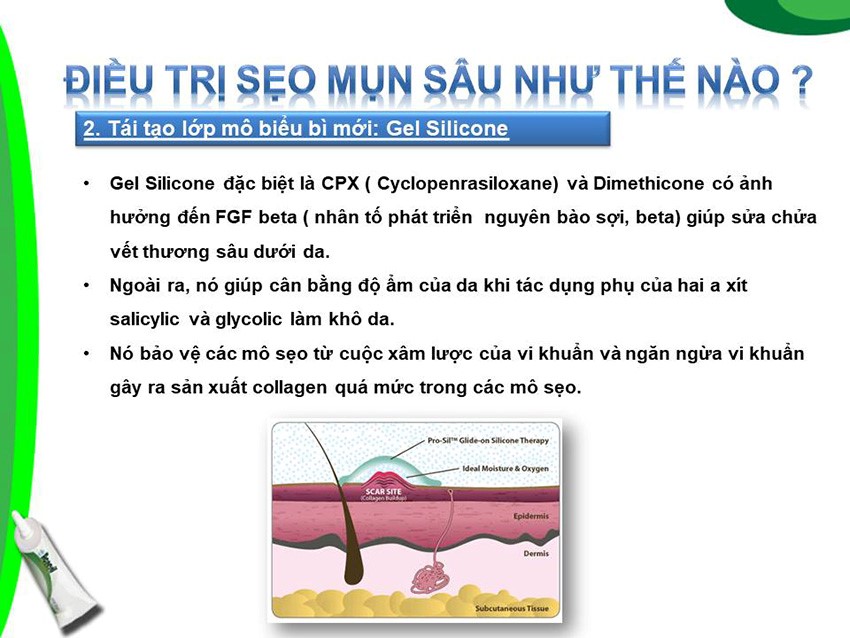 Acnesil Gel Silicone Cho Giải Pháp Hiệu Quả Cho Sẹo Mụn 10g Acnesil Gel Silicone Cho Giải Pháp Hiệu Quả Cho Sẹo Mụn 10g