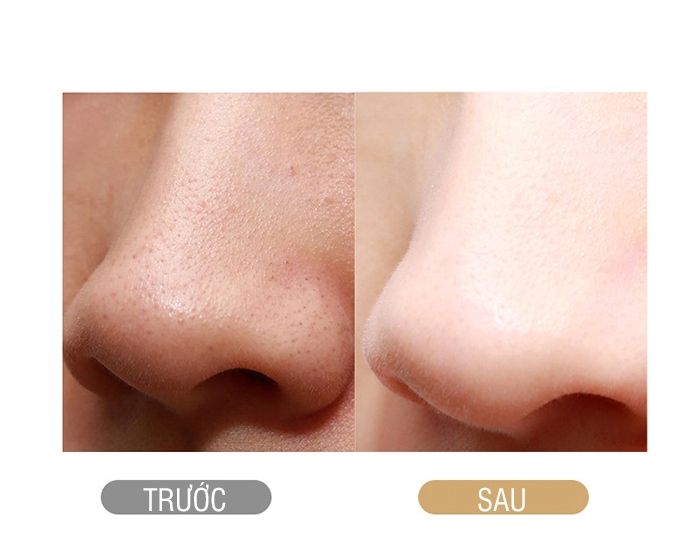 Máy nâng cơ mặt Nikio NK-122