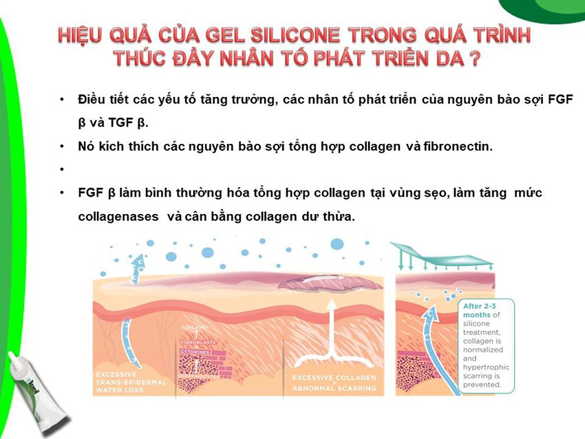 Acnesil Gel Silicone Cho Giải Pháp Hiệu Quả Cho Sẹo Mụn 10g Acnesil Gel Silicone Cho Giải Pháp Hiệu Quả Cho Sẹo Mụn 10g